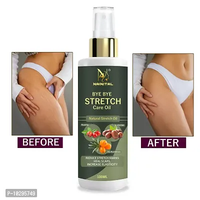 Nainital After Delivery Stretch Mark Removal Oil 100Ml-thumb0