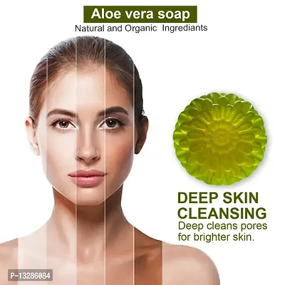 Aloe Vera Soap For Acne-Prone Skin -100 Grams-thumb0