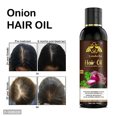 Hair Oil Black Seed Hair Oil 50Ml For Man And Women