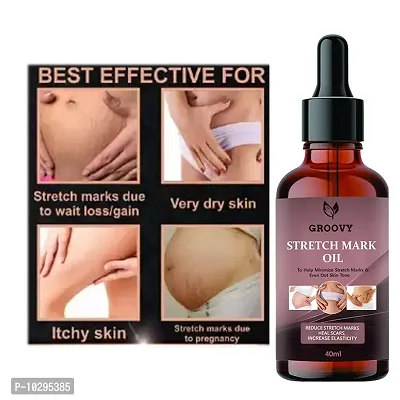 Stretch Marks Oil Stretch Mark Oil With The Goodness Of Seabuckthorn Oil, Vitamin E And C, Lavender All Skin Types For Scars And Stretch Marks-40Ml-thumb0