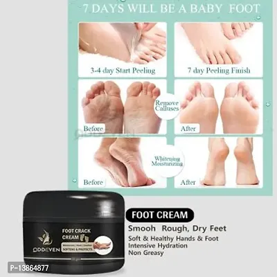 Foot Care Cream For Rough, Dry And Cracked Heel (50Gm) For Man And Woman.