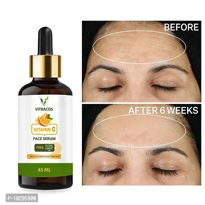 Vitracos Vitamin C+ Pure Glow Face Serum - With Hyaluronic Acid, Retinol, Niacinamide, Oranges, Berries And Turmeric - For Glowing, Bright, Young And Even Toned Skin - 45 Ml