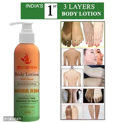 Skin Whitening Face Lotion For Oily Skin, Anti Pimple Lotion,- 100 Ml