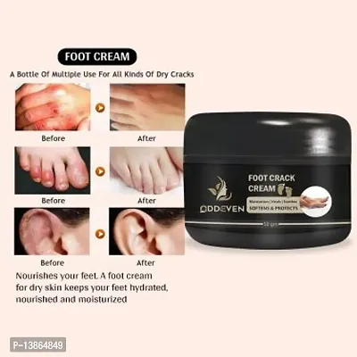 Foot Crack Cream For Woman (50Gm)