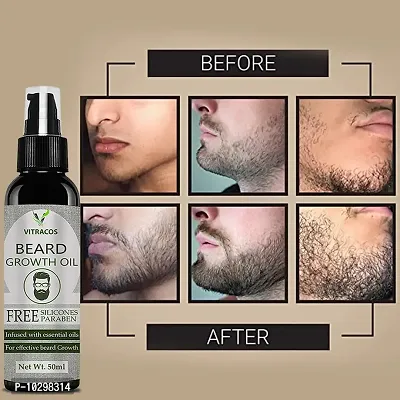 Vitracos Beard Oil Faster Growing Beard Oil With Goodness Of Avacado, Jojoba And Natural Oil For Men Reduce Breakage And Dryness Hair Oil- 50 ml