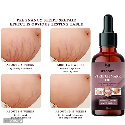 Stretch Marks Oil Stretch Marks Scar Removal Oil In During After Pregnancy Delivery Women, Organic Bio Oil,Anti Cellulite, Remover Scars 40Ml-thumb0