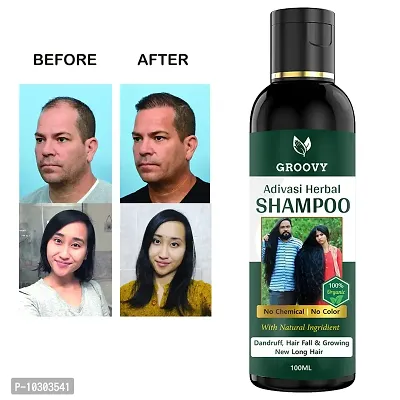 Neelambari Hair Medicine Shampoo For Hair Growth Or Dandruff Control -100 ml Shampoo - 100 Ml-thumb0
