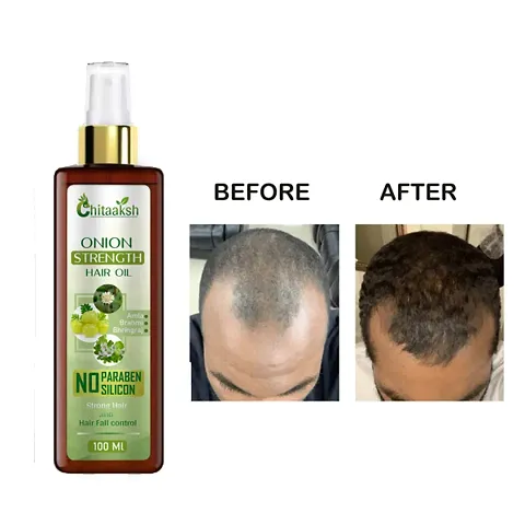 Chitaaksh Onion Hair Oil