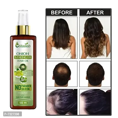nbsp;Onion Hair Oil - Black Seed Onion Hair Oil - Controls Hair Fall - For All Hair Problem Solution - No Mineral Oil, Colour, SLS, PEG for Men  Women (100 ml) Hair Oilnbsp;nbsp;(100 ml)-thumb0