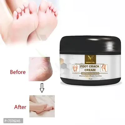 FEET NEED TO SPECIAL CARE FOR CRACK CREAM -50 gm