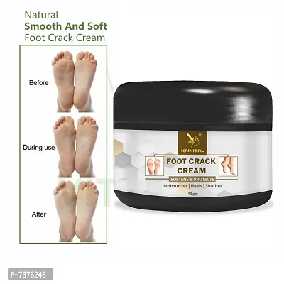 Foot Crack Cream for men (50gm)