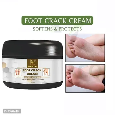 FOOT CRACK CREAM(JASMINE  GREEN TEA)50mgnbsp;nbsp;(50 g)