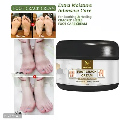 Foot Care Cream For Rough, Dry and Cracked Heel (50gm)