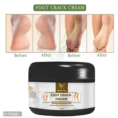 Foot Crack Cream For Dry Cracked Heels  Feet, 50 gms (pack of 1)