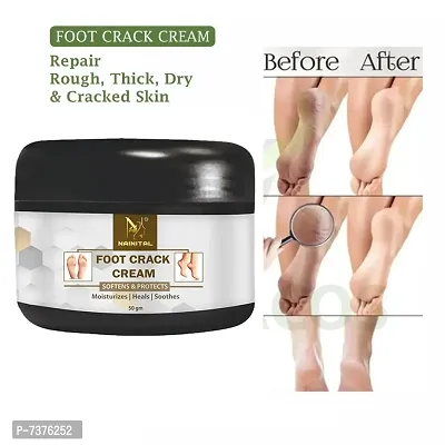 ugh, Dry and Cracked Heel | Feet Cream For Heel Repair |Healing  softening cream (50 gm.) Pack of 1-thumb0