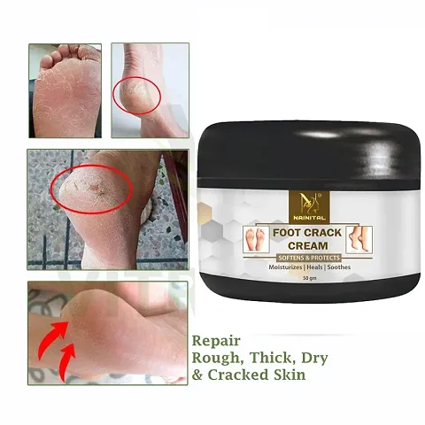 Hot Selling Foot Cream 