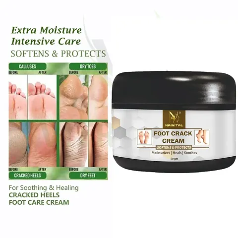 Hot Selling Foot Cream 