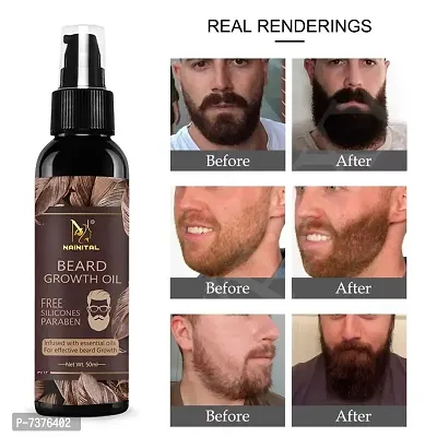 NAINITAL  Beard Growth Oil - More Beard Growth, 8 Natural Oils including Jojoba Oil, Vitamin E, Nourishment  Strengthening , No Harmful Chemical Hair Oil  (50 ml)