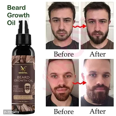 NAINITAL Beard Oil for Growing Beard Faster with Alm-thumb0