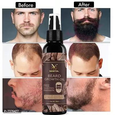 NAINITAL Beard Growth Oil - More Beard Growth, With Redensyl, 8 Natural Oils including Jojoba Oil, Vitamin E, Nourishment  Strengthening, No Harmful Chemical Hair Oil  (50 ml)