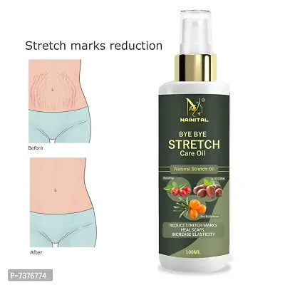 NAINITAL after delivery stretch mark removal OIL 100ML PACK OF 1-thumb0