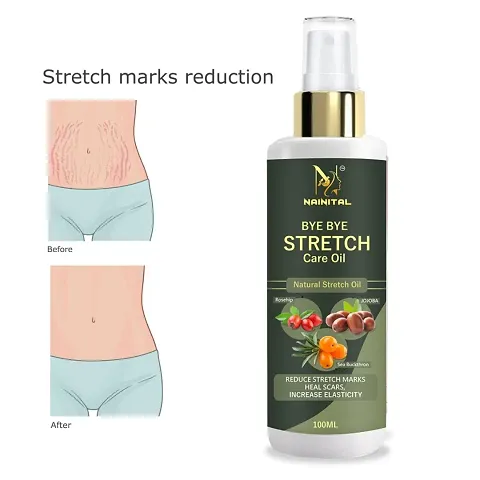 NAINITAL Stretch Mark Oil