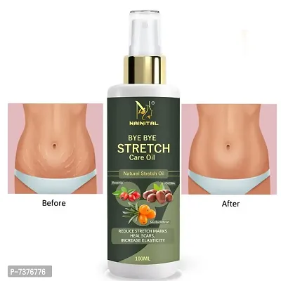 NAINITAL Advance Repair Stretch Marks Removal - Natural Heal Pregnancy Breast, Hip, Legs, Mark oil 100 ml pack of 1