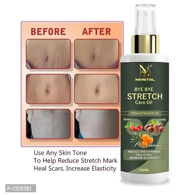 NAINITAL  Safe Organic Stretch Mark Oil  (100 ml)-thumb0