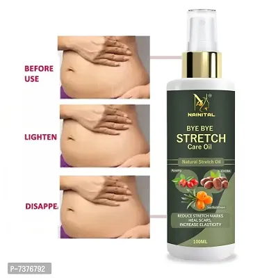 NAINITAL Stretch Mark Cream to Reduce Stretch Marks  Scars-100ML  (100 ml) PACK OF 1-thumb0