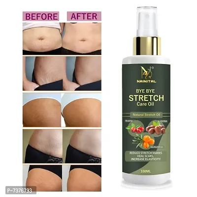 NAINITAL  Stretch Marks Oil to Reduce Stretch Marks of Body, Belly, Thighs, Nourishment For Woman  (100 ML-thumb0