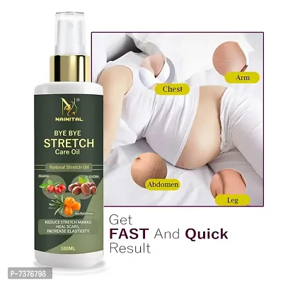 NAINITAL Bye Bye Stretch Marks Oil Pack of 1  (100 ml)