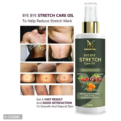 NAINITAL  Stretch Mark Oil for Women  Men - Scars, Uneven Skin T PACK OF 1