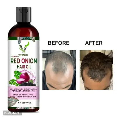 Onion Oil for Hair Regrowth  Hair Fall Control Hair Oil (100ml)-thumb0