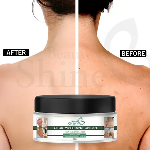 Pure Skin Whitening Cream At Best Price