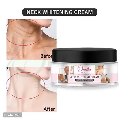 ELBOW WHITINING CREAM (PACK OF 1)