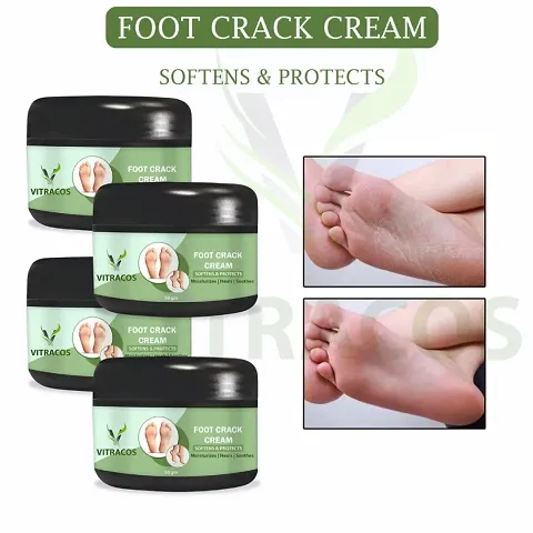 Best Foot care Foot Crack Cream
