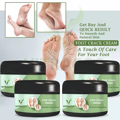 Top Quality Foot Cream Combo