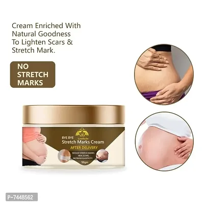 Stretch Marks Cream to Reduce Stretch Marks  Scars 50gm