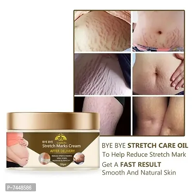Stretch Marks Cream to Reduce Stretch Marks  Scars 50gm-thumb0
