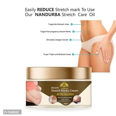 Stretch Marks Cream to Reduce Stretch Marks  Scars 50gm