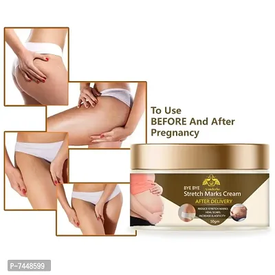 Stretch Marks Cream to Reduce Stretch Marks  Scars 50gm-thumb0