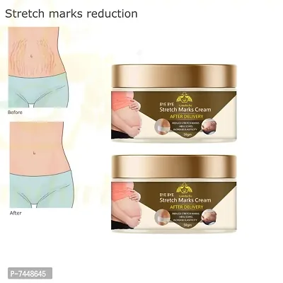 Stretch Marks Cream to Reduce Stretch Marks  Scars 50gm (PACK OF 2)-thumb0