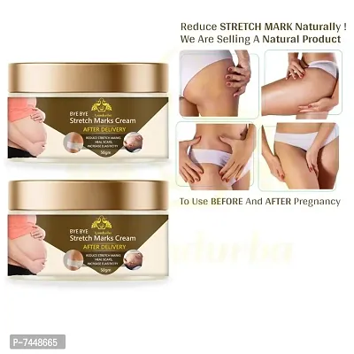 Stretch Marks Cream to Reduce Stretch Marks  Scars 50gm (PACK OF 2)