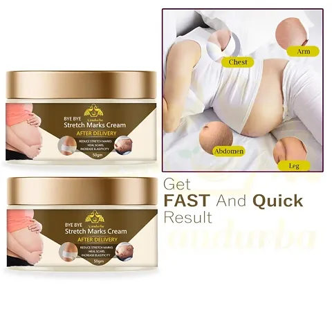 Stretch Marks Cream To Reduce Stretch Marks And Scars 50gm (Pack Of 2)