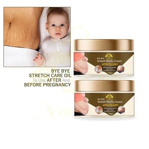 Stretch Marks Cream To Reduce Stretch Marks And Scars 50gm (Pack Of 2)