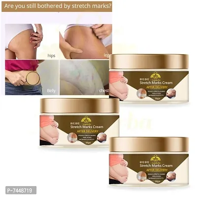 Stretch Marks Cream to Reduce Stretch Marks  Scars 50gm (PACK OF 3)
