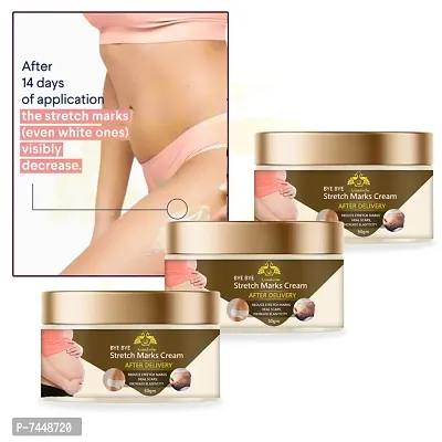 Stretch Marks Cream to Reduce Stretch Marks  Scars 50gm (PACK OF 3)