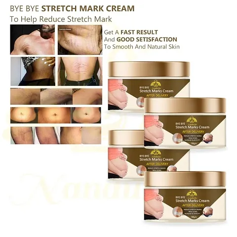 Stretch Marks Cream To Reduce Stretch Marks And Scars 50gm (Pack Of 4)