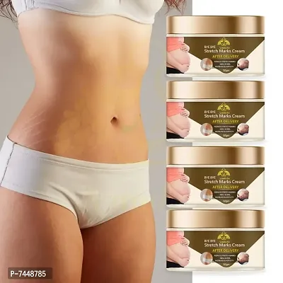 Stretch Marks Cream to Reduce Stretch Marks  Scars 50gm (PACK OF 4)