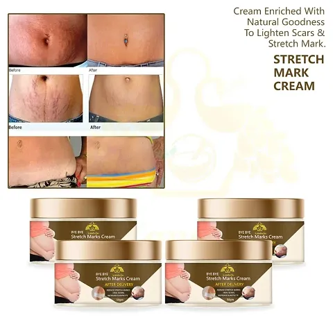 Stretch Marks Cream To Reduce Stretch Marks And Scars 50gm (Pack Of 4)